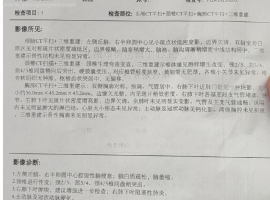 75岁老人肺癌有转移情况，是选择积极治疗还是姑息治