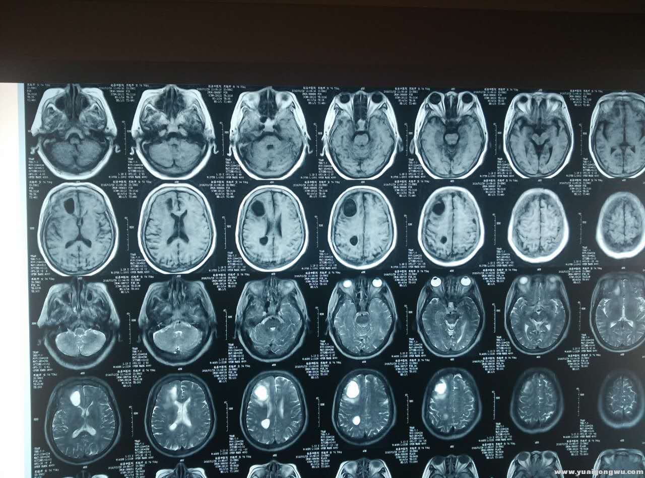 MRI 2016-2-29.jpg