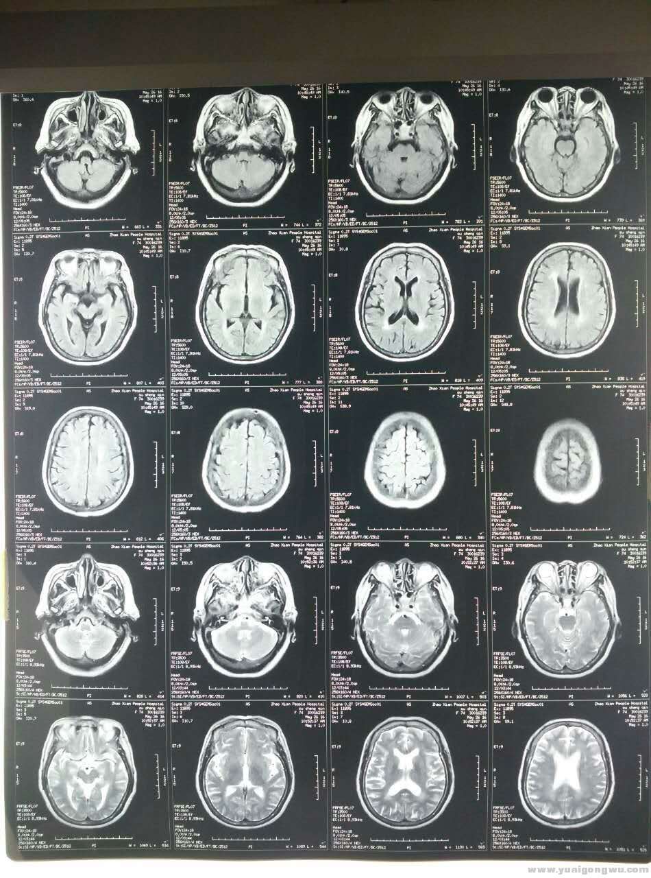 MRI 2016-5-26.jpg