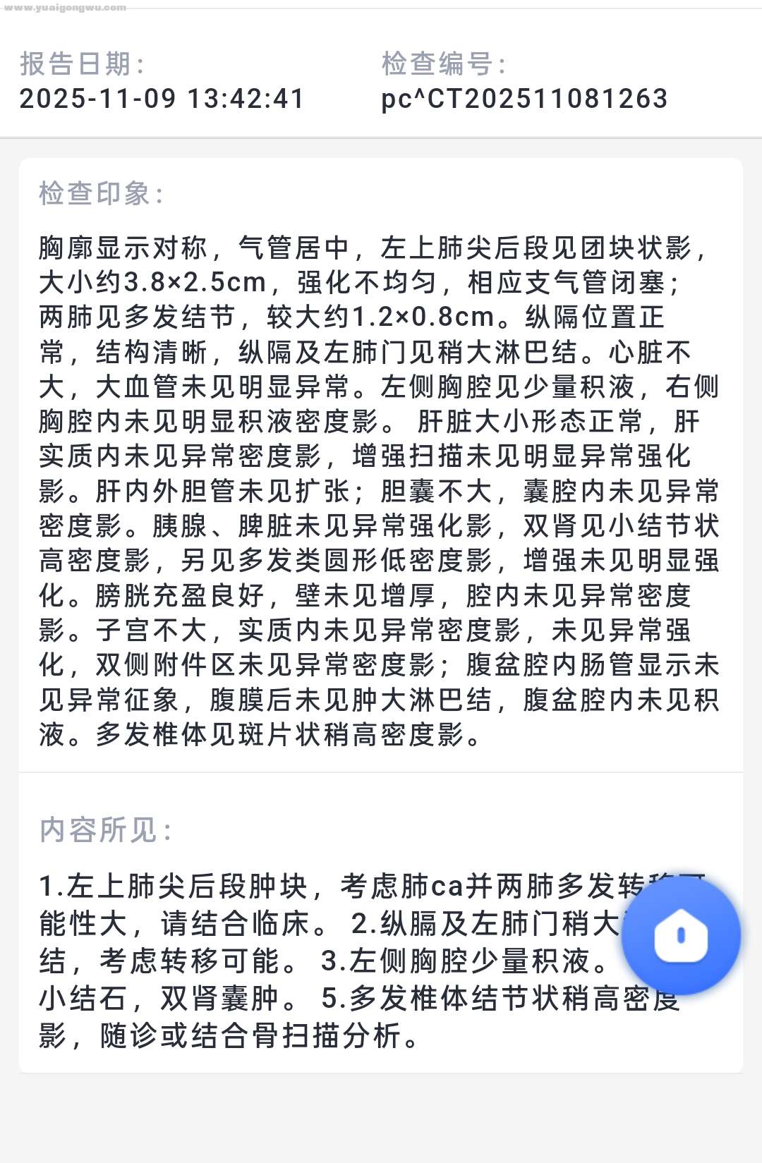 第一次治疗前增强CT