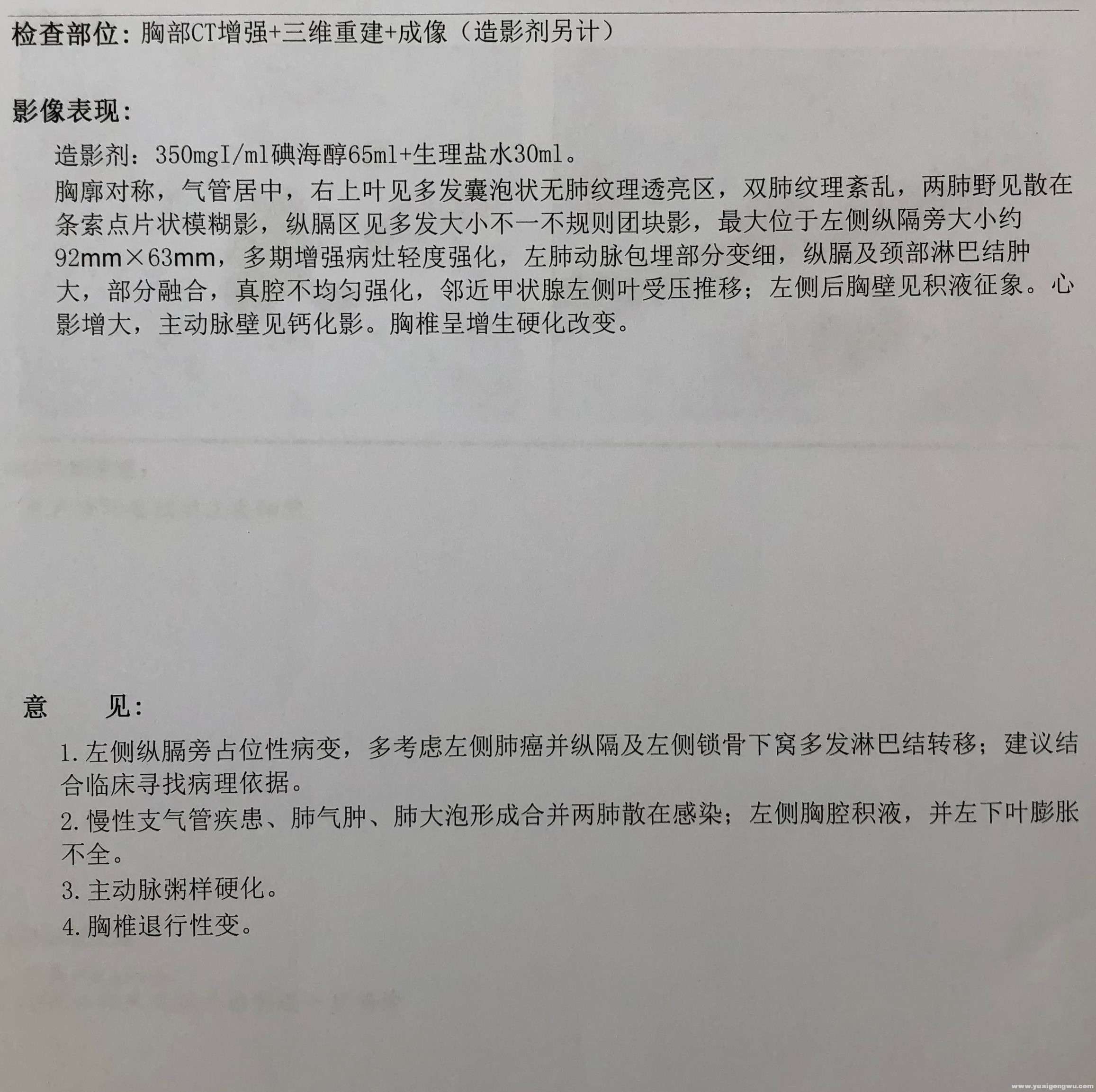 肺癌CT报告图片