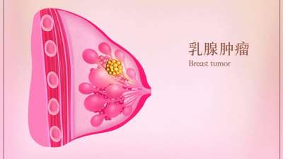 乳房重建，让身心不留遗憾